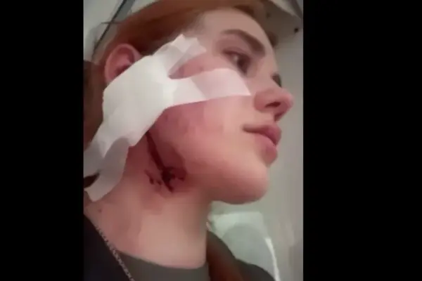 Побиття родини Кицай у Вроцлаві: офіційний запит і доручення Сибіги за день